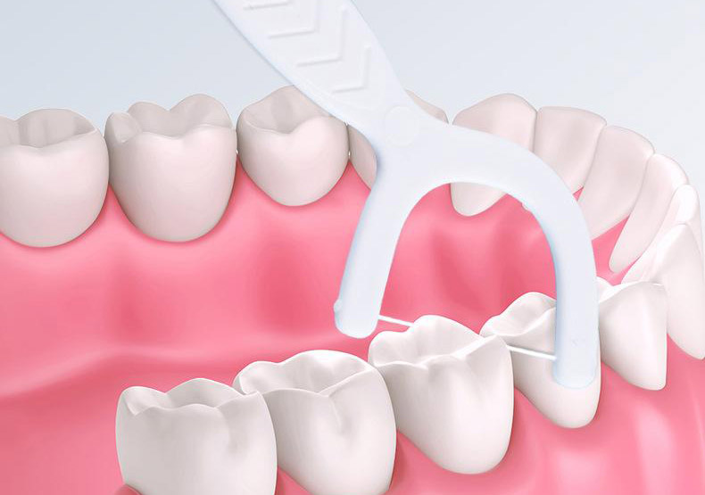 Types of Dental Floss: Choosing the Right One for Your Needs